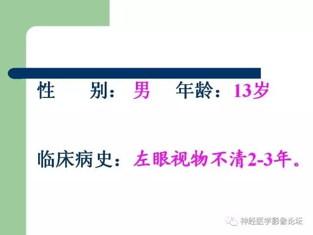 【病例】弥漫性星形细胞瘤1例CT及MR