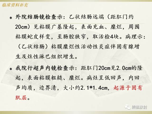 【病例】乙状结肠子宫内膜异位症1例CT诊断思路分析 【病例】乙状结肠子宫内膜异位症1例CT诊断思路分析