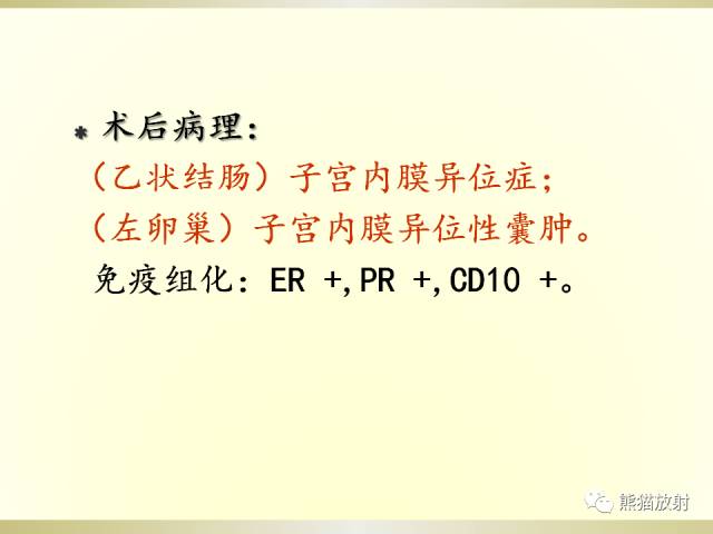 【病例】乙状结肠子宫内膜异位症1例CT诊断思路分析 【病例】乙状结肠子宫内膜异位症1例CT诊断思路分析
