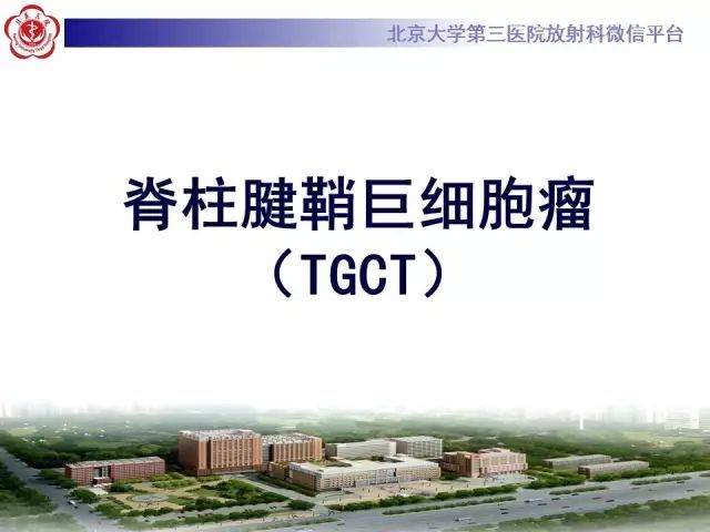 【病例】颈椎腱鞘巨细胞瘤1例CT及MR