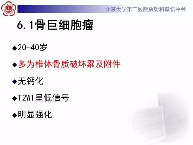 【病例】颈椎腱鞘巨细胞瘤1例CT及MR