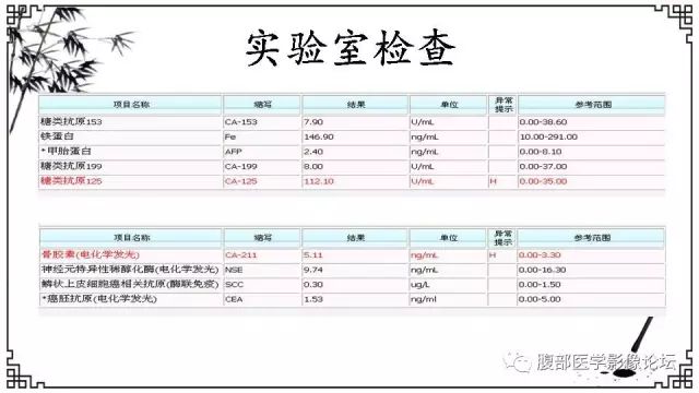 【病例】卵巢高级别浆液性癌1例CT及MR影像表现 【病例】卵巢高级别浆液性癌1例CT及MR影像表现