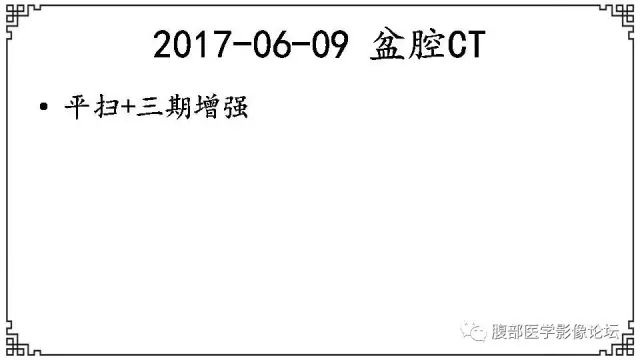 【病例】卵巢高级别浆液性癌1例CT及MR影像表现 【病例】卵巢高级别浆液性癌1例CT及MR影像表现