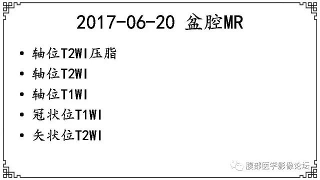 【病例】卵巢高级别浆液性癌1例CT及MR影像表现 【病例】卵巢高级别浆液性癌1例CT及MR影像表现