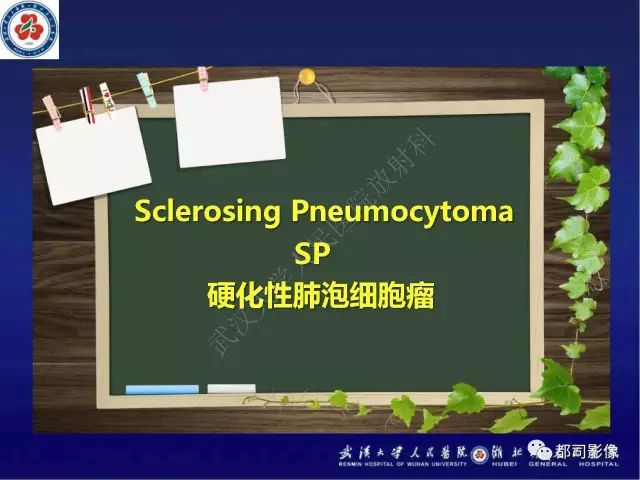 【病例】硬化性肺泡细胞瘤1例CT影像诊断
