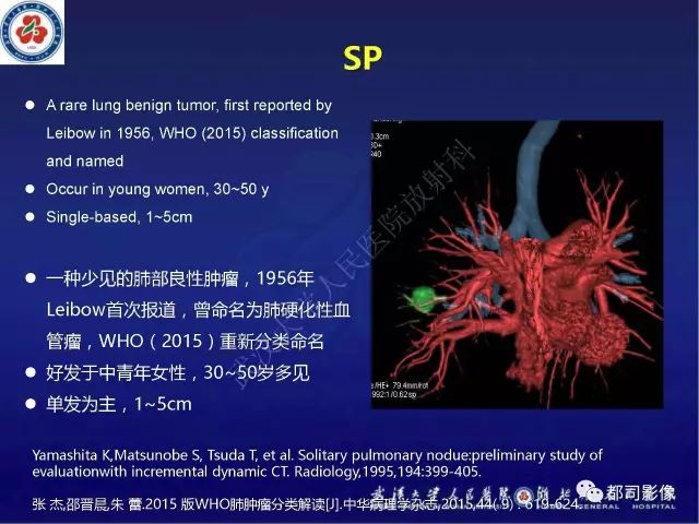【病例】硬化性肺泡细胞瘤1例CT影像诊断