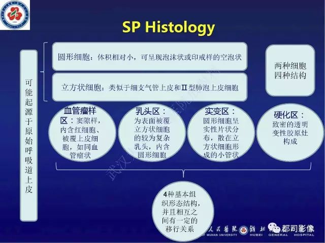 【病例】硬化性肺泡细胞瘤1例CT影像诊断