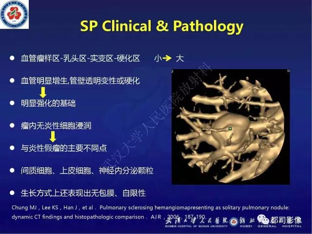 【病例】硬化性肺泡细胞瘤1例CT影像诊断