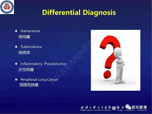 【病例】硬化性肺泡细胞瘤1例CT影像诊断