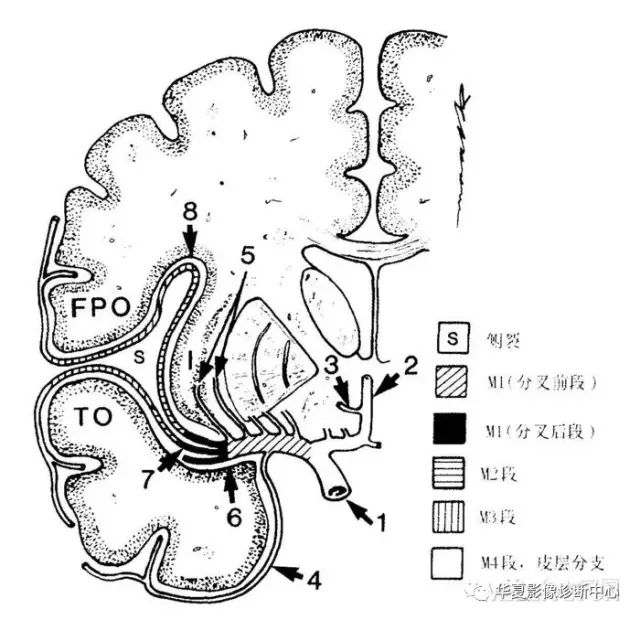 大脑中动脉分段详解（简图+DSA+实体解剖）
