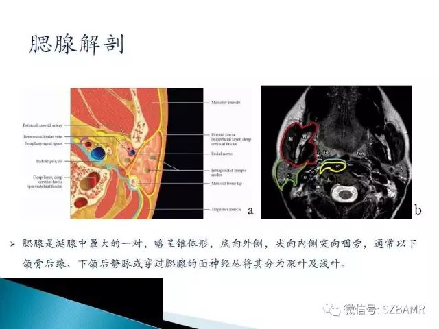 【PPT】涎腺解剖及涎石病影像表现
