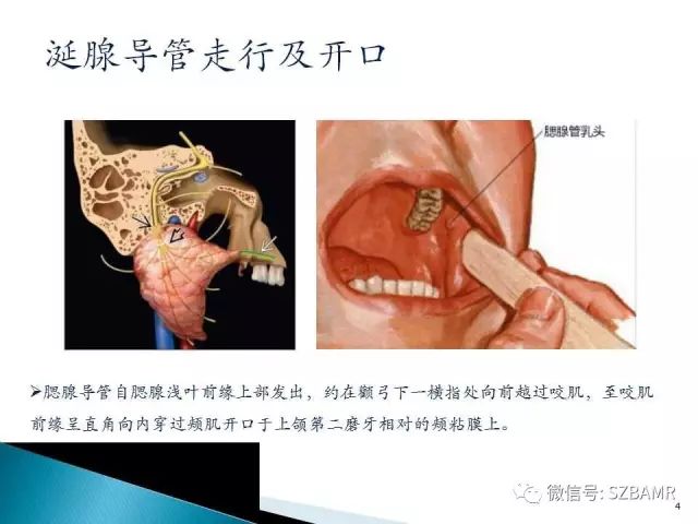 【PPT】涎腺解剖及涎石病影像表现