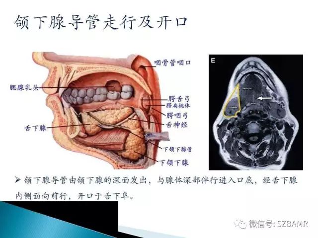 【PPT】涎腺解剖及涎石病影像表现
