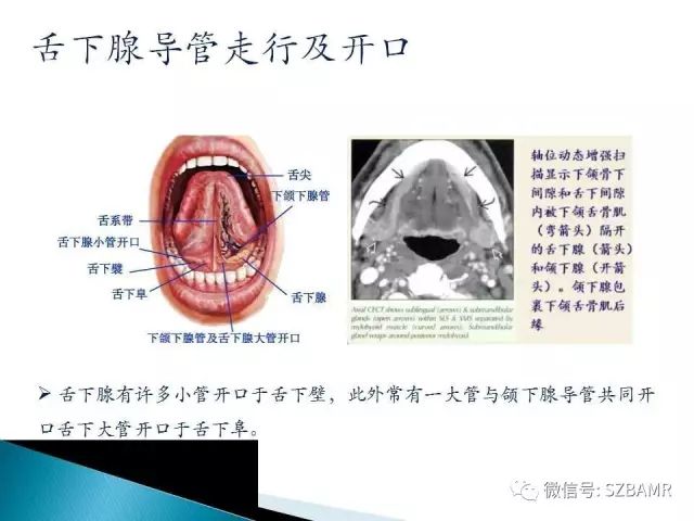 【PPT】涎腺解剖及涎石病影像表现