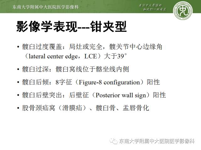 【病例】髋关节撞击综合征1例X线MR