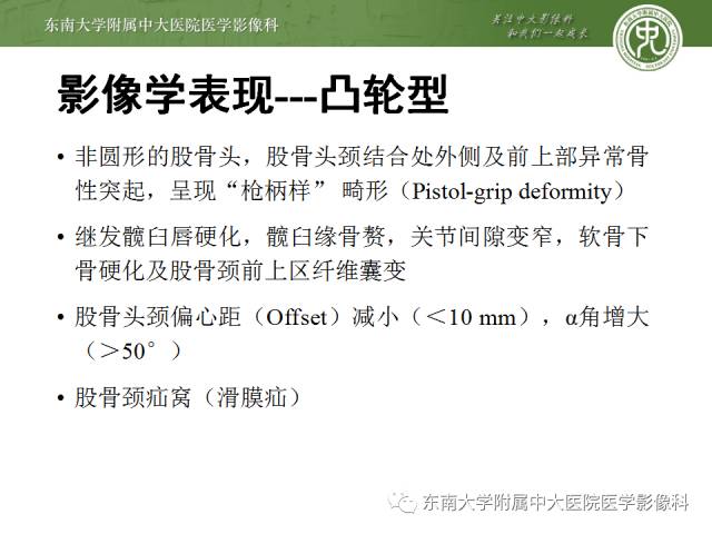 【病例】髋关节撞击综合征1例X线MR