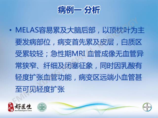 【病例】线粒体脑肌病1例MR