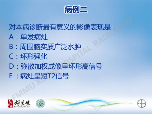 【病例】闹结核瘤1例MR影像特点