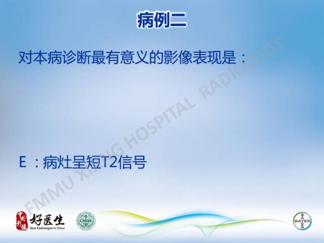 【病例】闹结核瘤1例MR影像特点