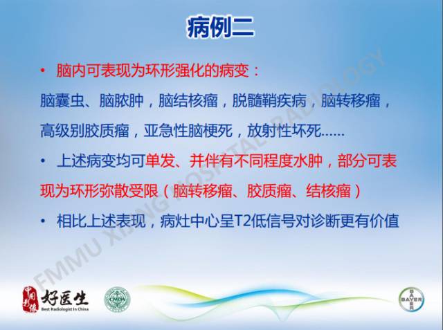 【病例】闹结核瘤1例MR影像特点