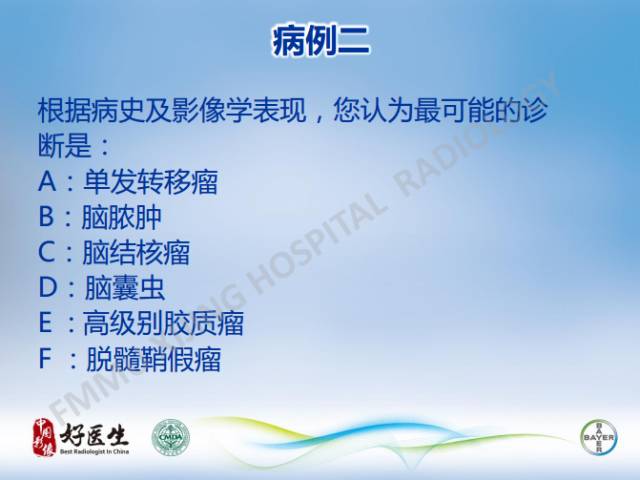 【病例】闹结核瘤1例MR影像特点