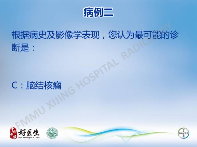 【病例】闹结核瘤1例MR影像特点