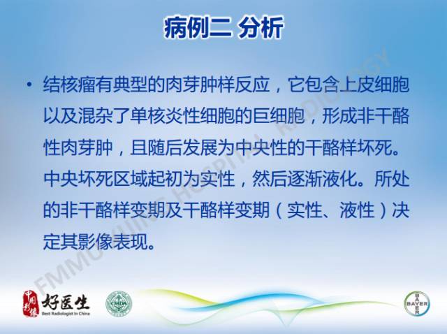 【病例】闹结核瘤1例MR影像特点