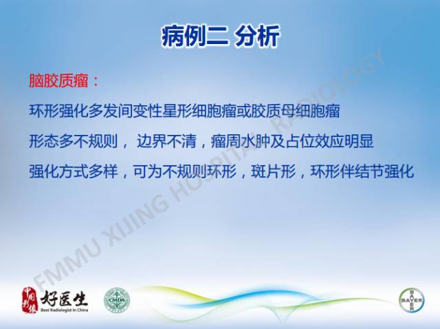 【病例】闹结核瘤1例MR影像特点