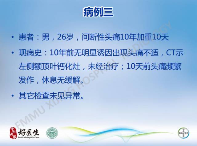 【病例】幕上室管膜瘤1例CT及MR影像表现
