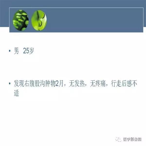 【病例】右侧大腿骨旁骨肉瘤1例CT及MR