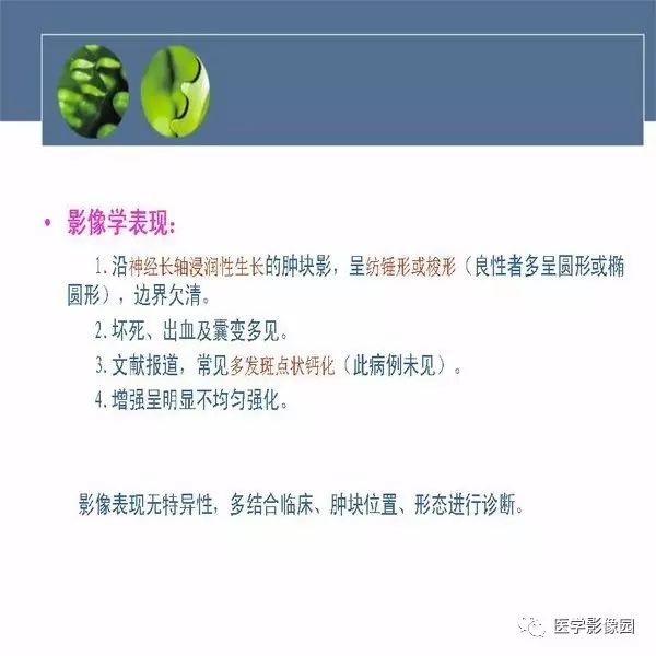 【病例】骨盆左侧恶性神经鞘瘤1例CT及MR