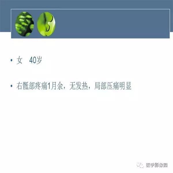 【病例】右侧髂骨恶性纤维组织细胞瘤1例CT及MR