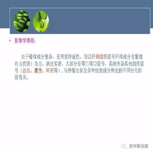 【病例】右侧髂骨恶性纤维组织细胞瘤1例CT及MR