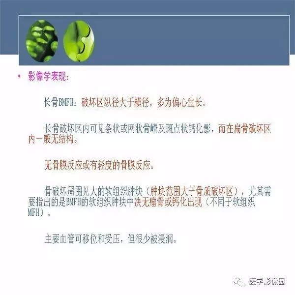 【病例】右侧髂骨恶性纤维组织细胞瘤1例CT及MR