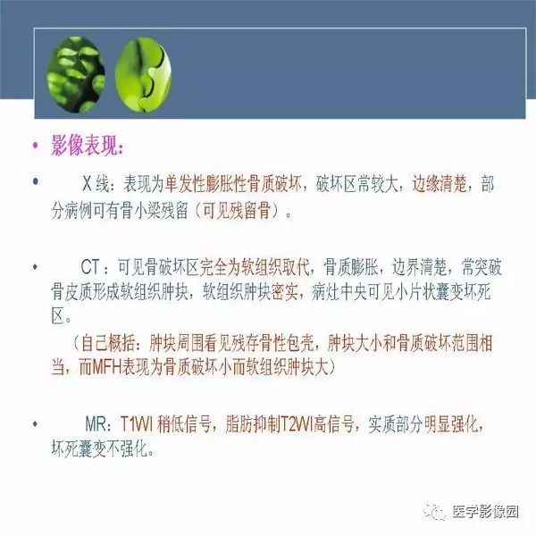【病例】左侧髂骨浆细胞性骨髓瘤1例CT及MR