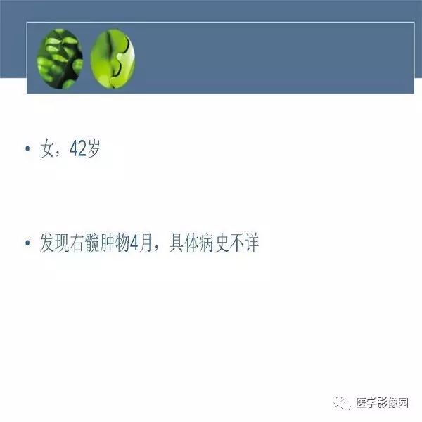 【病例】右侧髂骨甲状腺癌转移瘤1例CT及MR