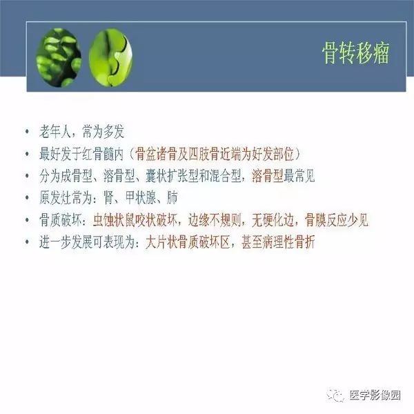 【病例】右侧髂骨甲状腺癌转移瘤1例CT及MR