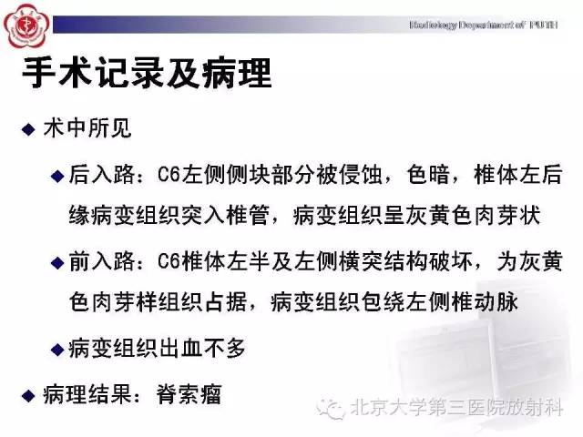 【病例】颈椎脊索瘤1例X线CT及MR