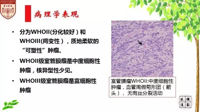【病例】室管膜瘤1例MR影像分析