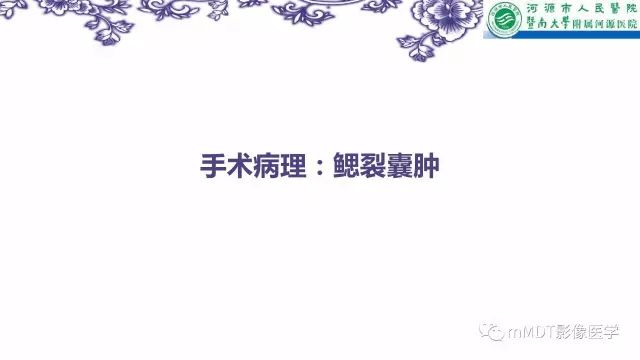 【PPT】鳃裂囊肿影像表现