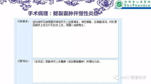 【PPT】鳃裂囊肿影像表现