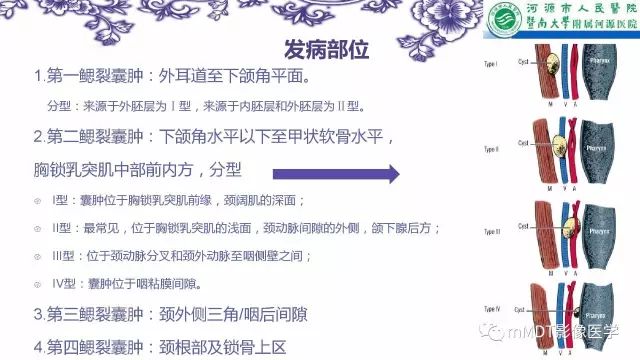 【PPT】鳃裂囊肿影像表现