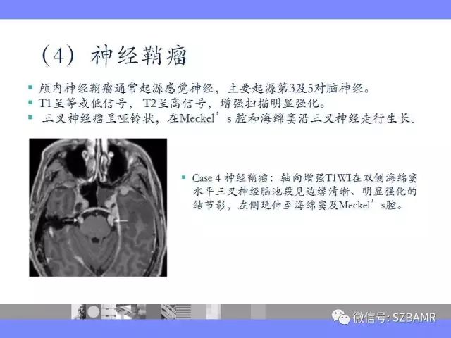 【PPT】海绵窦解剖及常见病变影像表现