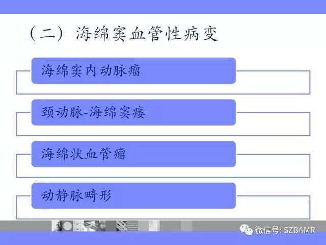 【PPT】海绵窦解剖及常见病变影像表现