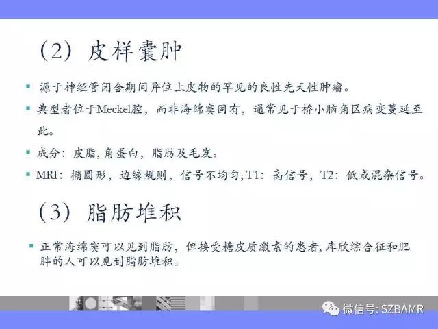 【PPT】海绵窦解剖及常见病变影像表现