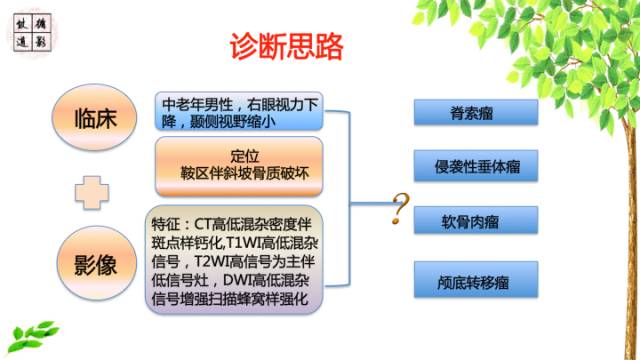 【病例】鞍区脊索瘤1例CT及MR影像表现
