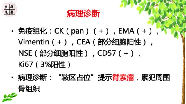 【病例】鞍区脊索瘤1例CT及MR影像表现