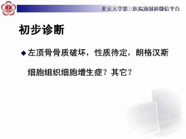 【病例】颅骨巨细胞修复性肉芽肿1例X线CT