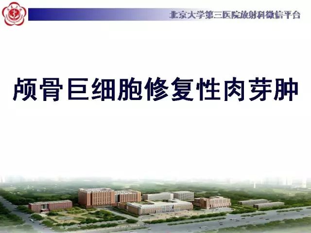 【病例】颅骨巨细胞修复性肉芽肿1例X线CT