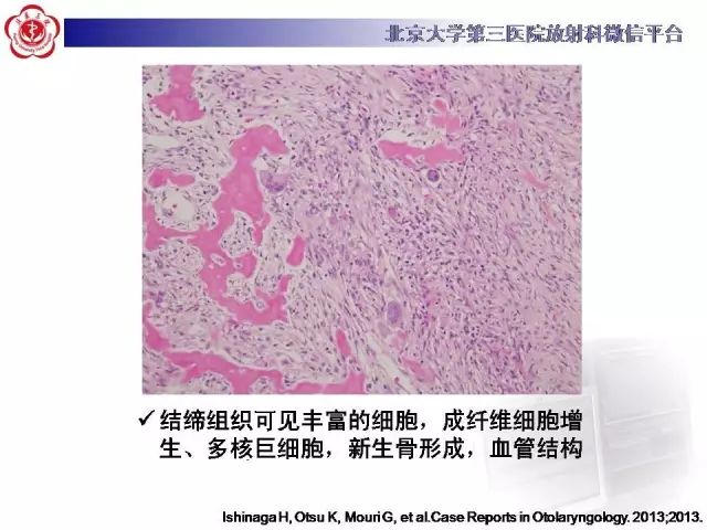 【病例】颅骨巨细胞修复性肉芽肿1例X线CT